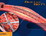 images/stories/Technology/Biosensors_stent.jpg