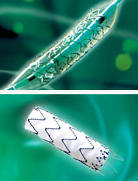 microport_coronary_stents